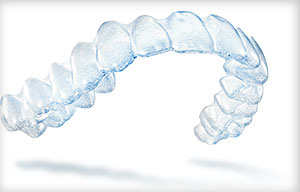 adult orthodontics dentist Monkton and Sparks MD