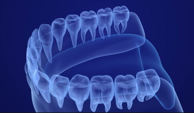 Intraoral cameras help dentists to see hard to reach places in patients' mouths.