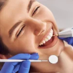 Dental Bonding smile