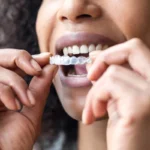 Oral Appliance Therapy